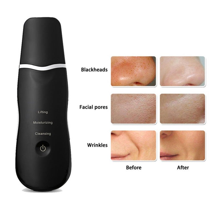 Ultrasonic Facial Deep Skin Scrubber (7)